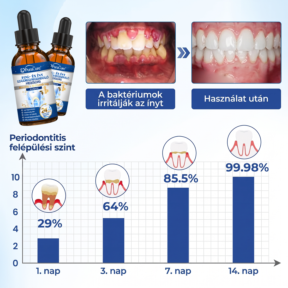 🦷𝐇𝐢𝐯𝐚𝐭𝐚𝐥𝐨𝐬 Á𝐫𝐮𝐡á𝐳 | 𝐏𝐮𝐫𝐚𝐂𝐮𝐫𝐞® 𝐅𝐨𝐠- é𝐬 Í𝐧𝐲 𝐒𝐳á𝐣ü𝐫𝐞𝐠𝐢 𝐑𝐞𝐠𝐞𝐧𝐞𝐫á𝐥ó 𝐎𝐥𝐝𝐚𝐭 | 𝐌é𝐡𝐦é𝐫𝐞𝐠-𝐩𝐞𝐩𝐭𝐢𝐝𝐞𝐤 × 𝐊𝐨𝐥𝐥𝐚𝐠é𝐧 × 𝐏𝐨𝐬𝐳𝐭𝐛𝐢𝐨𝐭𝐢𝐤𝐮𝐦𝐨𝐤 × 𝐁é𝐭𝐚-𝐠𝐥ü𝐤𝐚𝐧á𝐳 𝐞𝐫𝐞𝐣é𝐯𝐞𝐥 𝐚 𝐥𝐞𝐩𝐞𝐝é𝐤, 𝐟𝐨𝐠𝐤ő, 𝐟𝐨𝐠𝐟á𝐣á𝐬, 𝐫𝐨𝐬𝐬𝐳 𝐥𝐞𝐡𝐞𝐥𝐞𝐭 é𝐬 𝐠𝐲𝐞𝐧𝐠𝐞 𝐟𝐨𝐠𝐚𝐤 𝐞𝐥𝐥𝐞𝐧