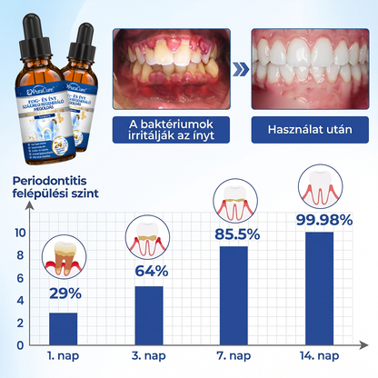🦷𝐇𝐢𝐯𝐚𝐭𝐚𝐥𝐨𝐬 Á𝐫𝐮𝐡á𝐳 | 𝐏𝐮𝐫𝐚𝐂𝐮𝐫𝐞® 𝐅𝐨𝐠- é𝐬 Í𝐧𝐲 𝐒𝐳á𝐣ü𝐫𝐞𝐠𝐢 𝐑𝐞𝐠𝐞𝐧𝐞𝐫á𝐥ó 𝐎𝐥𝐝𝐚𝐭 | 𝐌é𝐡𝐦é𝐫𝐞𝐠-𝐩𝐞𝐩𝐭𝐢𝐝𝐞𝐤 × 𝐊𝐨𝐥𝐥𝐚𝐠é𝐧 × 𝐏𝐨𝐬𝐳𝐭𝐛𝐢𝐨𝐭𝐢𝐤𝐮𝐦𝐨𝐤 × 𝐁é𝐭𝐚-𝐠𝐥ü𝐤𝐚𝐧á𝐳 𝐞𝐫𝐞𝐣é𝐯𝐞𝐥 𝐚 𝐥𝐞𝐩𝐞𝐝é𝐤, 𝐟𝐨𝐠𝐤ő, 𝐟𝐨𝐠𝐟á𝐣á𝐬, 𝐫𝐨𝐬𝐬𝐳 𝐥𝐞𝐡𝐞𝐥𝐞𝐭 é𝐬 𝐠𝐲𝐞𝐧𝐠𝐞 𝐟𝐨𝐠𝐚𝐤 𝐞𝐥𝐥𝐞𝐧