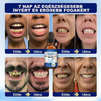 🦷𝐇𝐢𝐯𝐚𝐭𝐚𝐥𝐨𝐬 Á𝐫𝐮𝐡á𝐳 | 𝐏𝐮𝐫𝐚𝐂𝐮𝐫𝐞® 𝐅𝐨𝐠- é𝐬 Í𝐧𝐲 𝐒𝐳á𝐣ü𝐫𝐞𝐠𝐢 𝐑𝐞𝐠𝐞𝐧𝐞𝐫á𝐥ó 𝐎𝐥𝐝𝐚𝐭 | 𝐌é𝐡𝐦é𝐫𝐞𝐠-𝐩𝐞𝐩𝐭𝐢𝐝𝐞𝐤 × 𝐊𝐨𝐥𝐥𝐚𝐠é𝐧 × 𝐏𝐨𝐬𝐳𝐭𝐛𝐢𝐨𝐭𝐢𝐤𝐮𝐦𝐨𝐤 × 𝐁é𝐭𝐚-𝐠𝐥ü𝐤𝐚𝐧á𝐳 𝐞𝐫𝐞𝐣é𝐯𝐞𝐥 𝐚 𝐥𝐞𝐩𝐞𝐝é𝐤, 𝐟𝐨𝐠𝐤ő, 𝐟𝐨𝐠𝐟á𝐣á𝐬, 𝐫𝐨𝐬𝐬𝐳 𝐥𝐞𝐡𝐞𝐥𝐞𝐭 é𝐬 𝐠𝐲𝐞𝐧𝐠𝐞 𝐟𝐨𝐠𝐚𝐤 𝐞𝐥𝐥𝐞𝐧