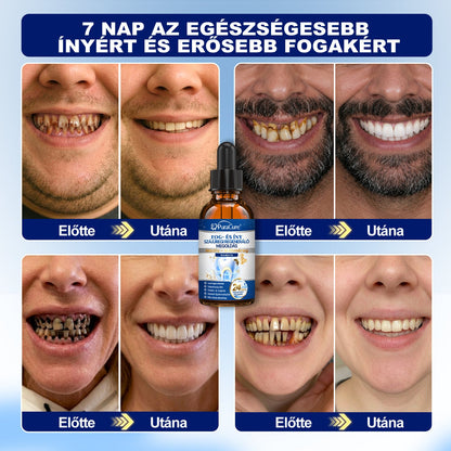 🦷𝐇𝐢𝐯𝐚𝐭𝐚𝐥𝐨𝐬 Á𝐫𝐮𝐡á𝐳 | 𝐏𝐮𝐫𝐚𝐂𝐮𝐫𝐞® 𝐅𝐨𝐠- é𝐬 Í𝐧𝐲 𝐒𝐳á𝐣ü𝐫𝐞𝐠𝐢 𝐑𝐞𝐠𝐞𝐧𝐞𝐫á𝐥ó 𝐎𝐥𝐝𝐚𝐭 | 𝐌é𝐡𝐦é𝐫𝐞𝐠-𝐩𝐞𝐩𝐭𝐢𝐝𝐞𝐤 × 𝐊𝐨𝐥𝐥𝐚𝐠é𝐧 × 𝐏𝐨𝐬𝐳𝐭𝐛𝐢𝐨𝐭𝐢𝐤𝐮𝐦𝐨𝐤 × 𝐁é𝐭𝐚-𝐠𝐥ü𝐤𝐚𝐧á𝐳 𝐞𝐫𝐞𝐣é𝐯𝐞𝐥 𝐚 𝐥𝐞𝐩𝐞𝐝é𝐤, 𝐟𝐨𝐠𝐤ő, 𝐟𝐨𝐠𝐟á𝐣á𝐬, 𝐫𝐨𝐬𝐬𝐳 𝐥𝐞𝐡𝐞𝐥𝐞𝐭 é𝐬 𝐠𝐲𝐞𝐧𝐠𝐞 𝐟𝐨𝐠𝐚𝐤 𝐞𝐥𝐥𝐞𝐧