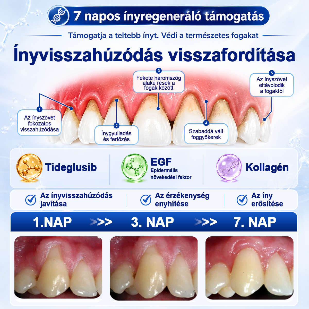 🦷𝐇𝐢𝐯𝐚𝐭𝐚𝐥𝐨𝐬 Á𝐫𝐮𝐡á𝐳 | 𝐏𝐮𝐫𝐚𝐂𝐮𝐫𝐞® 𝐅𝐨𝐠- é𝐬 Í𝐧𝐲 𝐒𝐳á𝐣ü𝐫𝐞𝐠𝐢 𝐑𝐞𝐠𝐞𝐧𝐞𝐫á𝐥ó 𝐎𝐥𝐝𝐚𝐭 | 𝐌é𝐡𝐦é𝐫𝐞𝐠-𝐩𝐞𝐩𝐭𝐢𝐝𝐞𝐤 × 𝐊𝐨𝐥𝐥𝐚𝐠é𝐧 × 𝐏𝐨𝐬𝐳𝐭𝐛𝐢𝐨𝐭𝐢𝐤𝐮𝐦𝐨𝐤 × 𝐁é𝐭𝐚-𝐠𝐥ü𝐤𝐚𝐧á𝐳 𝐞𝐫𝐞𝐣é𝐯𝐞𝐥 𝐚 𝐥𝐞𝐩𝐞𝐝é𝐤, 𝐟𝐨𝐠𝐤ő, 𝐟𝐨𝐠𝐟á𝐣á𝐬, 𝐫𝐨𝐬𝐬𝐳 𝐥𝐞𝐡𝐞𝐥𝐞𝐭 é𝐬 𝐠𝐲𝐞𝐧𝐠𝐞 𝐟𝐨𝐠𝐚𝐤 𝐞𝐥𝐥𝐞𝐧