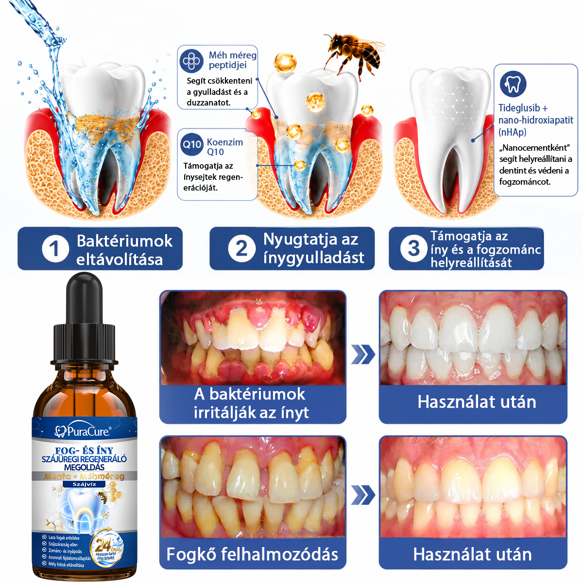 🦷𝐇𝐢𝐯𝐚𝐭𝐚𝐥𝐨𝐬 Á𝐫𝐮𝐡á𝐳 | 𝐏𝐮𝐫𝐚𝐂𝐮𝐫𝐞® 𝐅𝐨𝐠- é𝐬 Í𝐧𝐲 𝐒𝐳á𝐣ü𝐫𝐞𝐠𝐢 𝐑𝐞𝐠𝐞𝐧𝐞𝐫á𝐥ó 𝐎𝐥𝐝𝐚𝐭 | 𝐌é𝐡𝐦é𝐫𝐞𝐠-𝐩𝐞𝐩𝐭𝐢𝐝𝐞𝐤 × 𝐊𝐨𝐥𝐥𝐚𝐠é𝐧 × 𝐏𝐨𝐬𝐳𝐭𝐛𝐢𝐨𝐭𝐢𝐤𝐮𝐦𝐨𝐤 × 𝐁é𝐭𝐚-𝐠𝐥ü𝐤𝐚𝐧á𝐳 𝐞𝐫𝐞𝐣é𝐯𝐞𝐥 𝐚 𝐥𝐞𝐩𝐞𝐝é𝐤, 𝐟𝐨𝐠𝐤ő, 𝐟𝐨𝐠𝐟á𝐣á𝐬, 𝐫𝐨𝐬𝐬𝐳 𝐥𝐞𝐡𝐞𝐥𝐞𝐭 é𝐬 𝐠𝐲𝐞𝐧𝐠𝐞 𝐟𝐨𝐠𝐚𝐤 𝐞𝐥𝐥𝐞𝐧