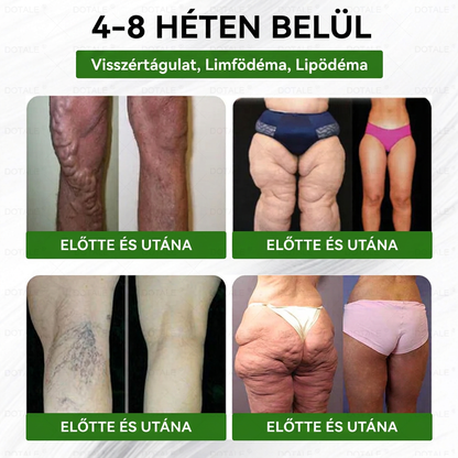 🚀DOTALE Metabolic Nano Microneedle Patch (Napi mindössze egyszeri használat, látható változások 7 nap alatt)